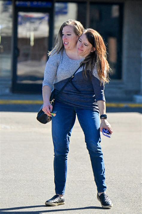 Abby And Brittany Hensel Anatomy