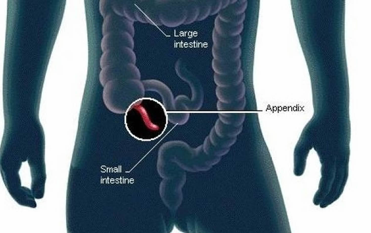 Debunking the Myth: The True Purpose of Appendix in a Book