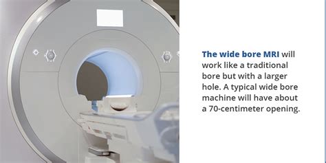 Benefits Of Wide Bore Mri Imaging Technology News