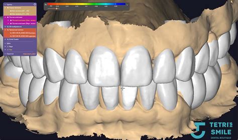 Digital Smile Design Pricing In Miami Sunny Isles