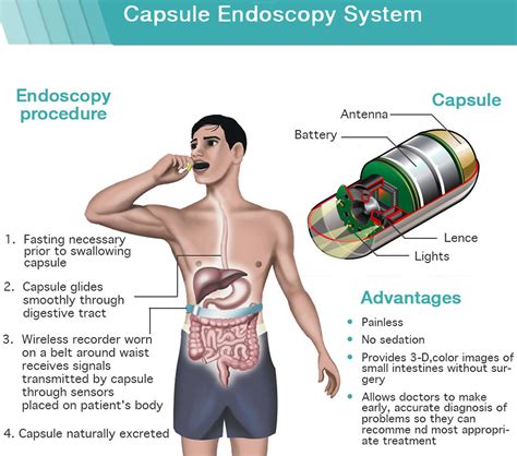 The Journey to Clear Vision: Conquering Endoscopy Prep