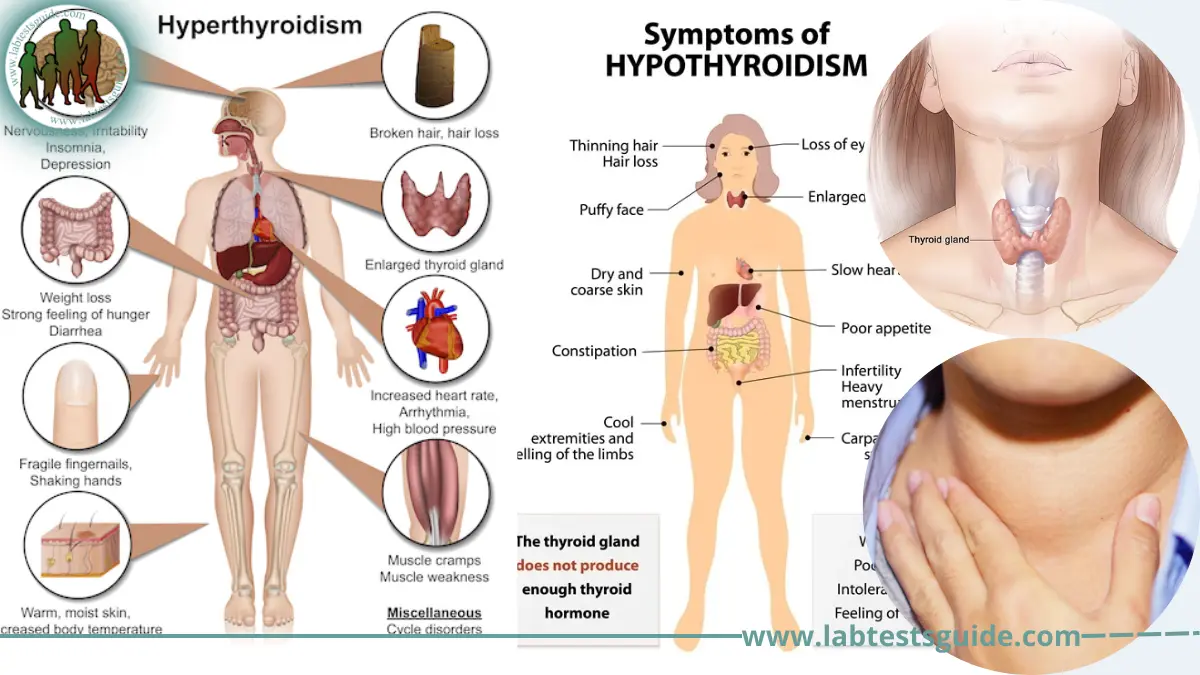 Healthyr Thyroid At Home Test For Hypothyroidism And Hyperthyroidism With Lab Fee Included Hsa Fsa Eligible Walmart Com Healthyr Thyroid At Home Test For Hypothyroidism And Hyperthyroidism With Lab Fee Included Hsa Fsa Eligible Walmart Com