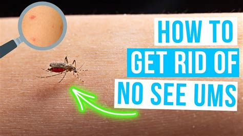 How To Get Rid Of No See Ums