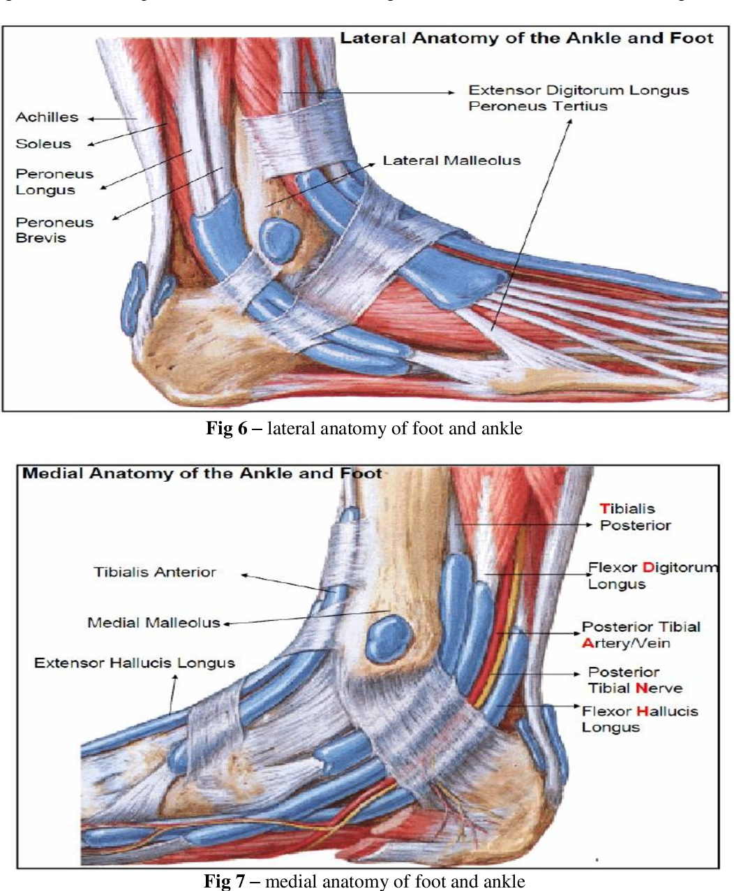 Medial Vastus Muscle