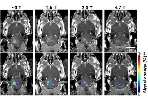 Mri S Magnetic Field Affects Focused Ultrasound Technology The Source Washu