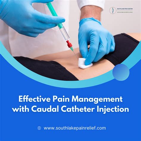 Pain Management With Caudal Catheter Injection In Southlake Tx