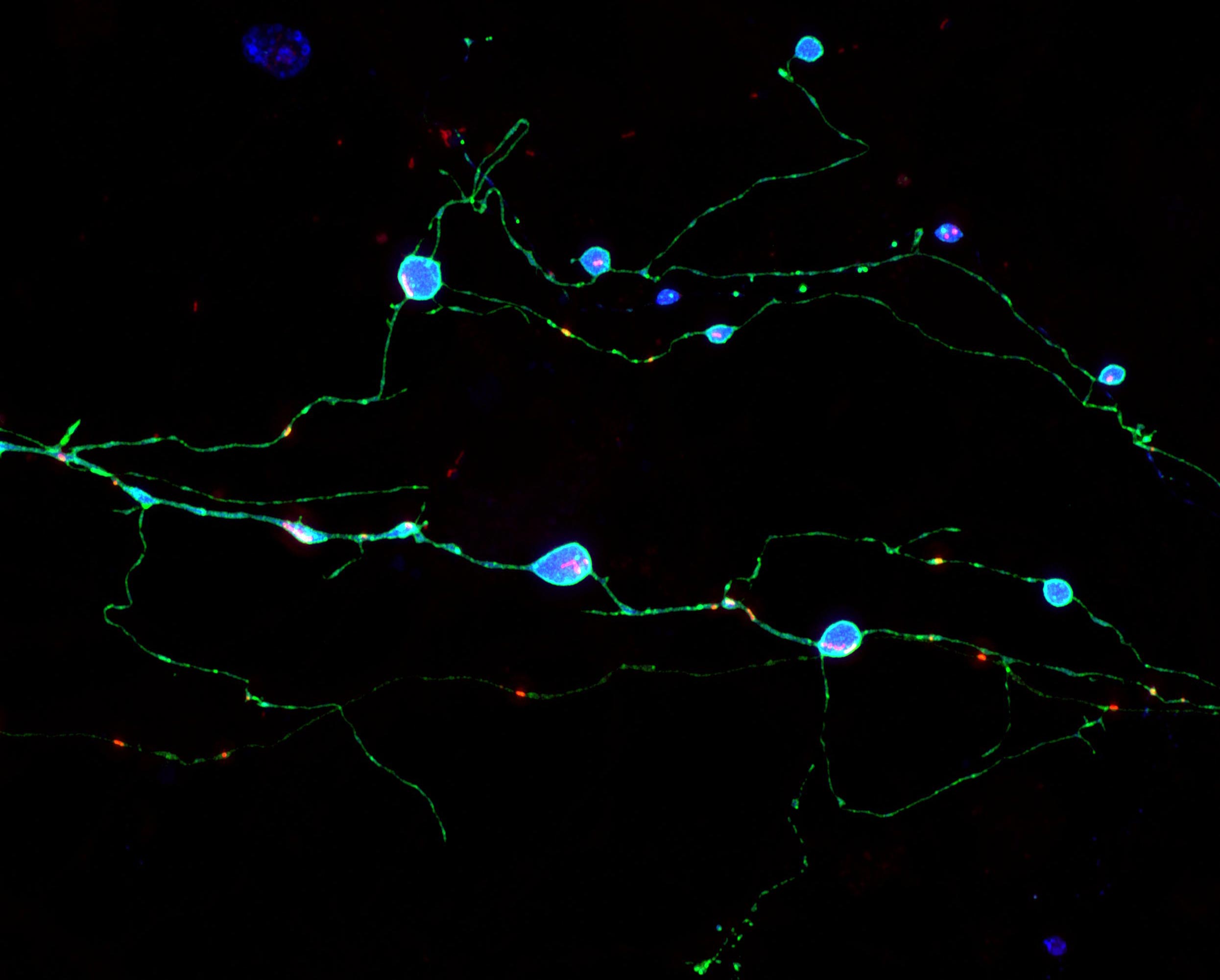 Prion Diseases Conformational Changes Of A Protein Create An Unconventional Infectious Agent Sciencedirect