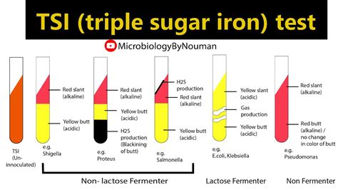 Understanding the Triple Sugar Iron Test: What It Reveals About Your Health