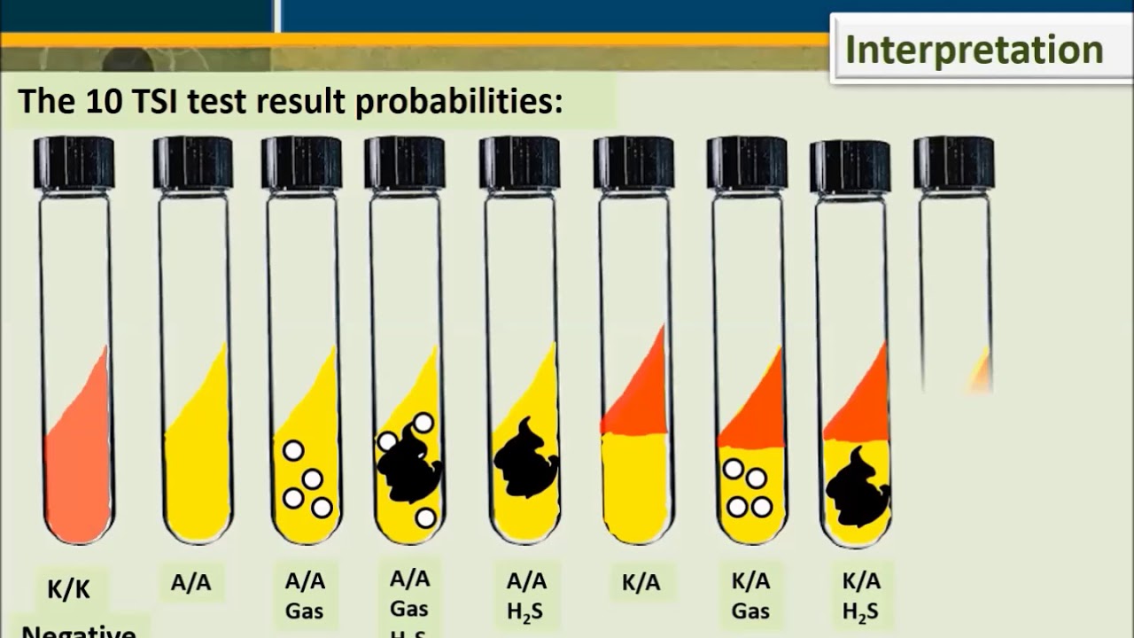 Tsi Triple Sugar Iron Test Results