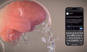 Elon-musk-neuralink-first-patient-trial-recovery